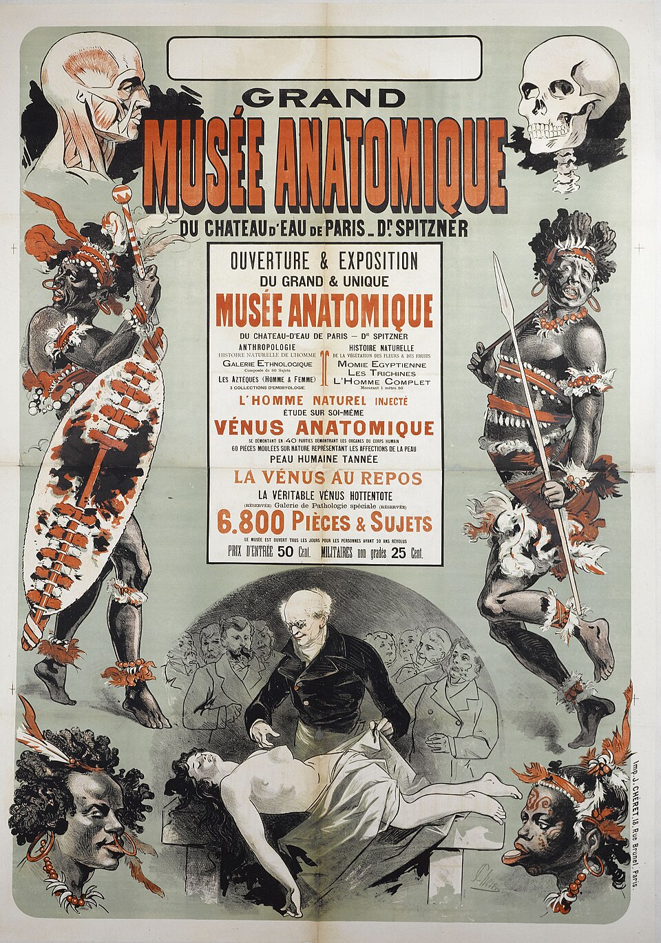 Grand Musée anatomique du château d'Eau de Paris - Dr Spitzner